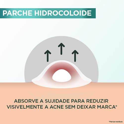 Pimple Patch Garnier